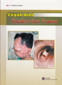 Image of CEGAH DINI KANKER DAN TUMOR